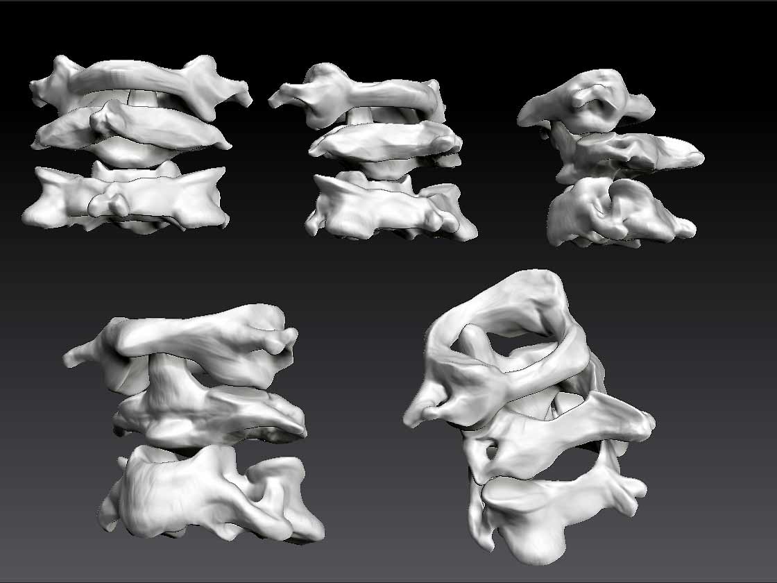 3cervicalVerts.jpg