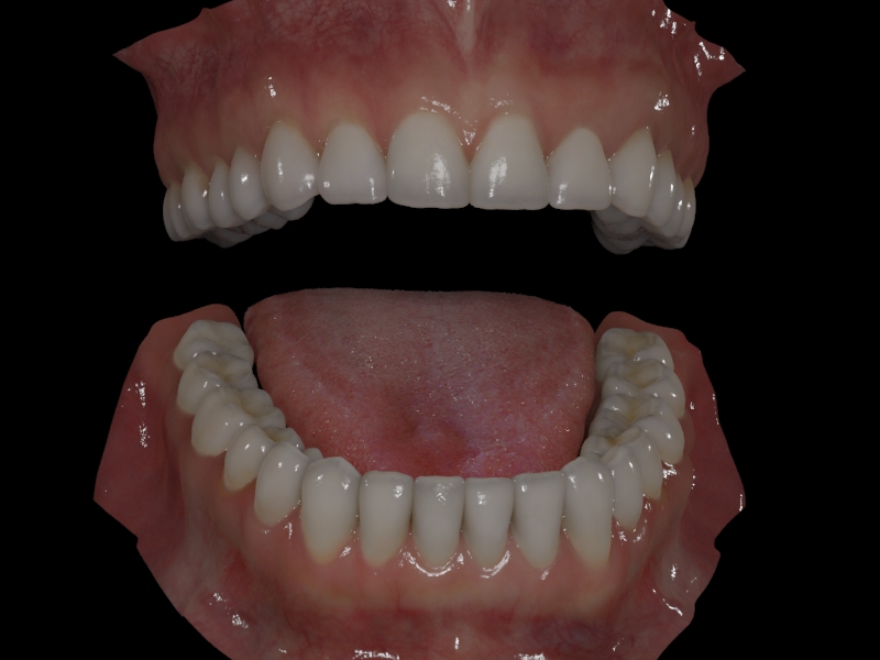 dents du bas 0353.jpg