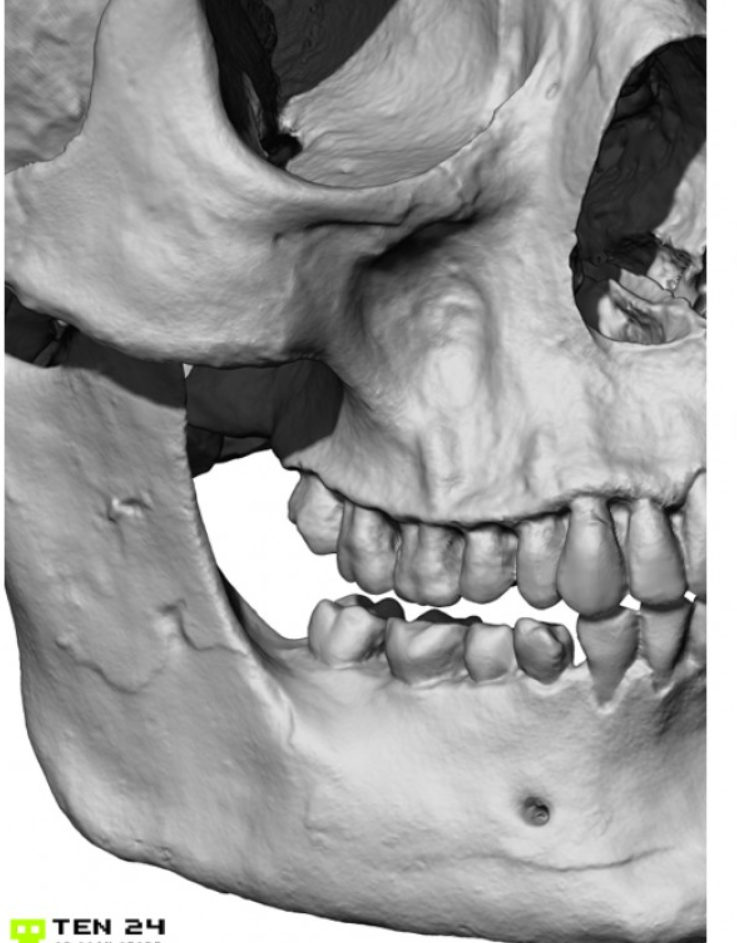 teeth.PNG