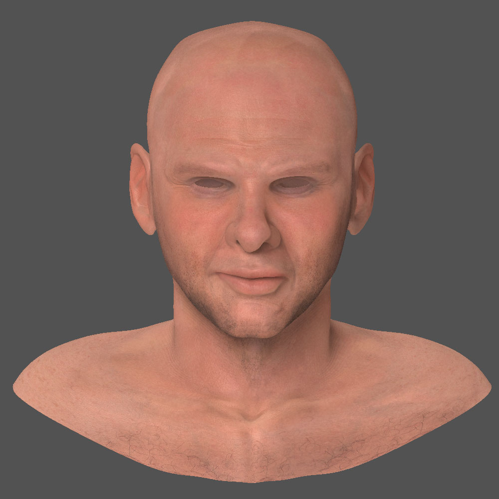 skin_Front.jpg