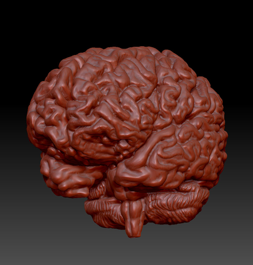 zBrain-6.jpg