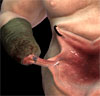 thumb.jpg