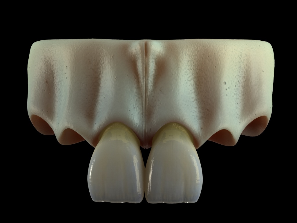 hueso+dientes1.jpg