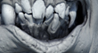 thumb.jpg