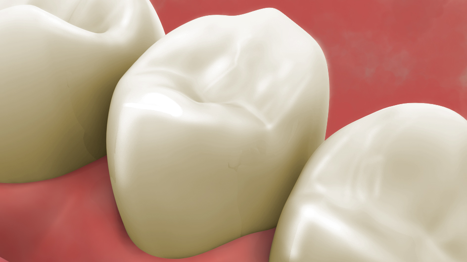 tooth-screening.jpg