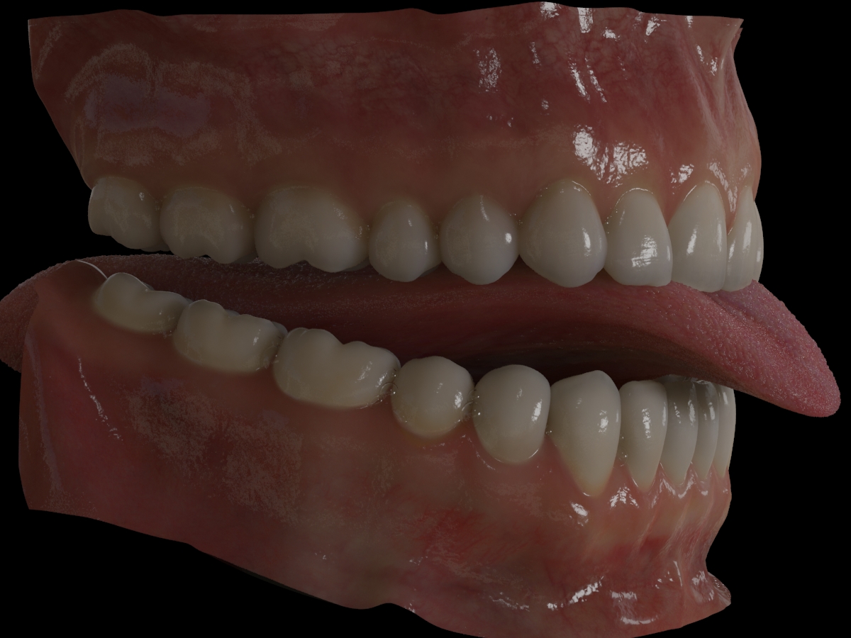 dents du bas 0362.jpg