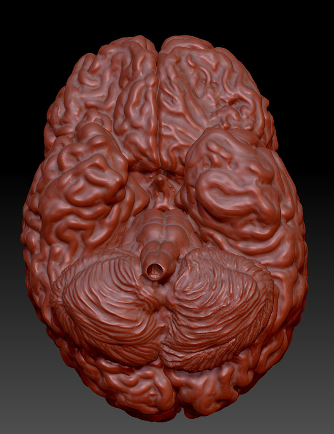 zBrain-5.jpg
