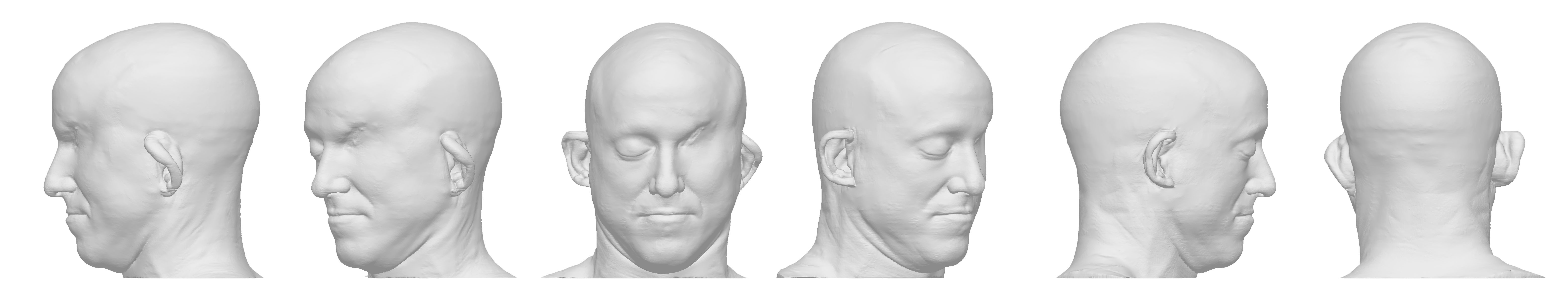 eye-replacement-turnaround.jpg