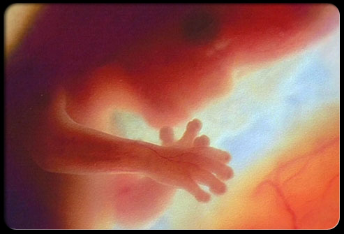 fetal_12_week_fetus_s5.jpg