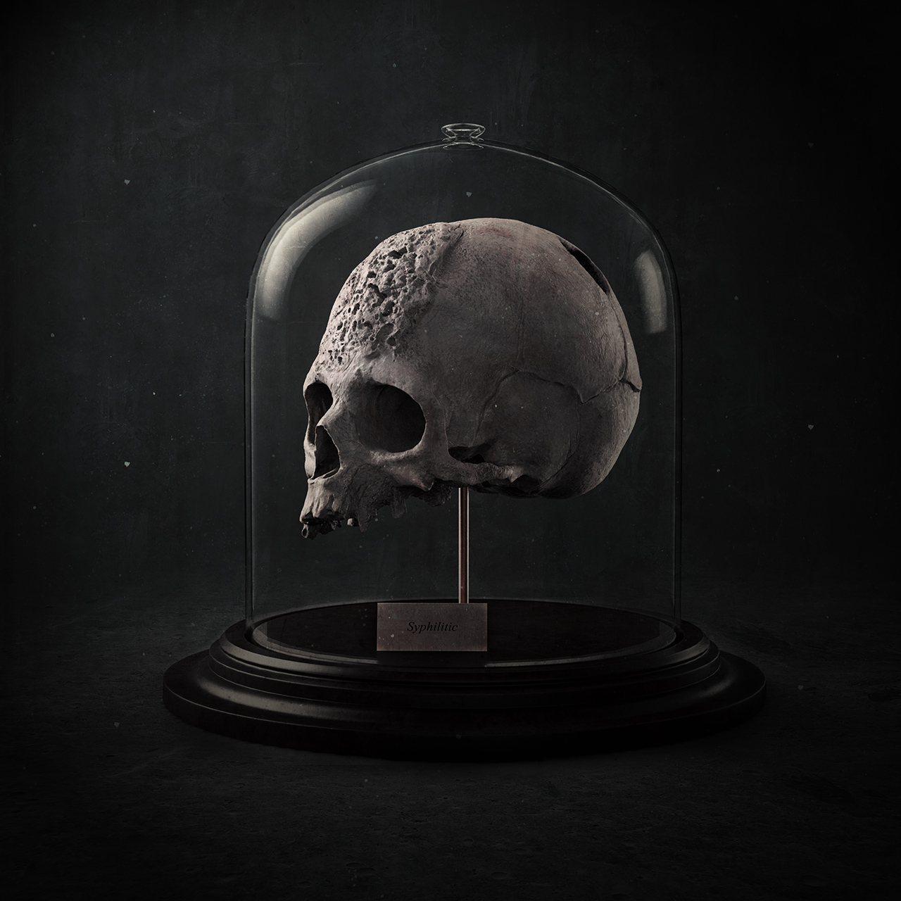 Syphilitic-Skull.jpg