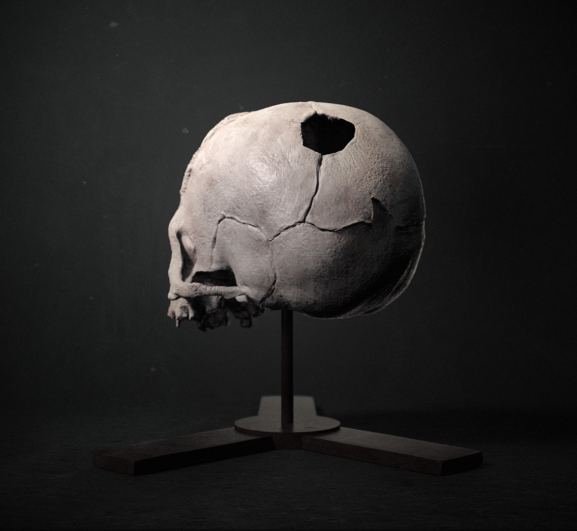 Syphilis Skull Render 03.jpg