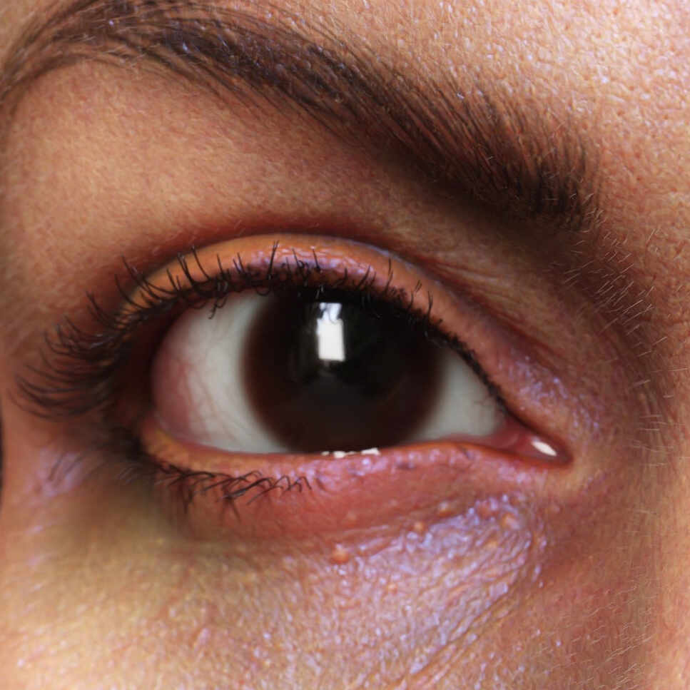 eye_01square