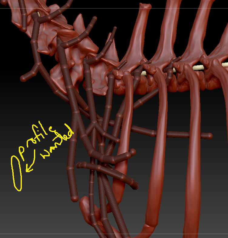 zspheres