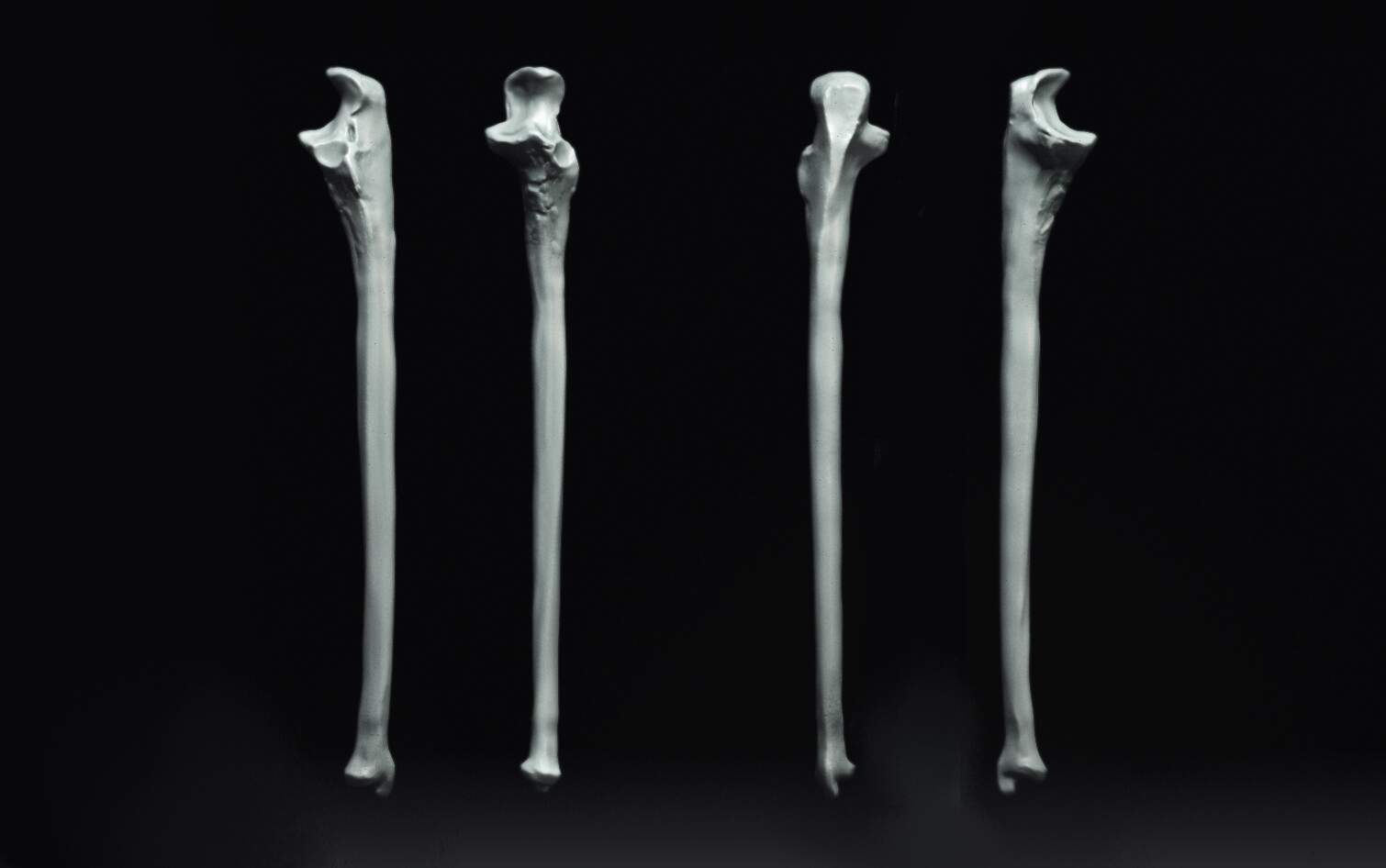 Ulna3