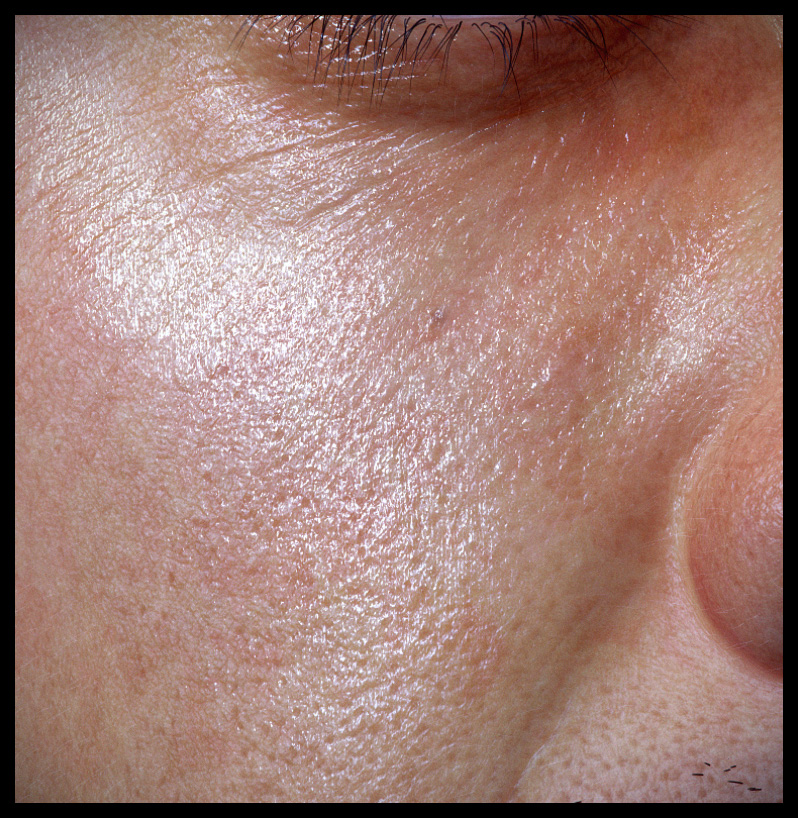 closeup 1.jpg