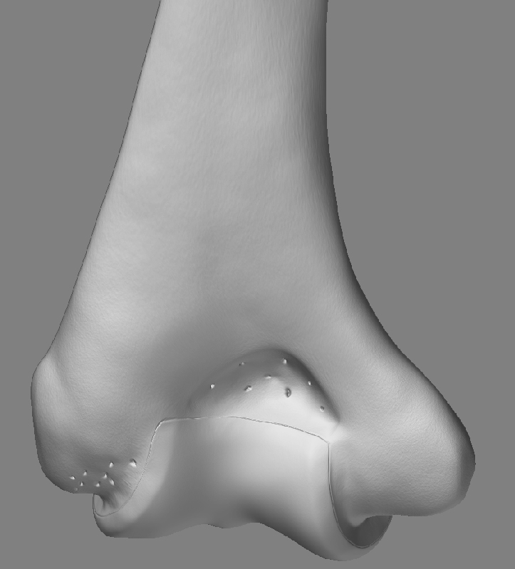 HumerusBottomBack_02.jpg