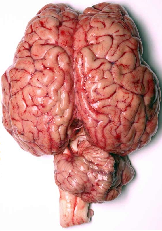 Brain_002.jpg