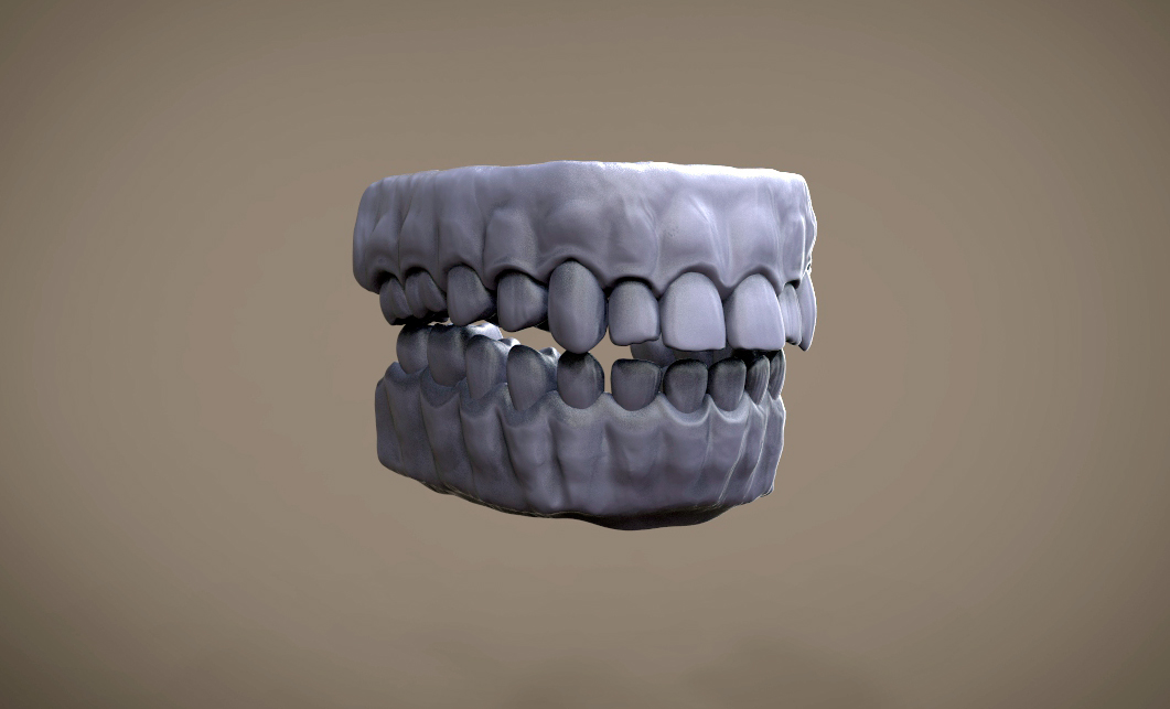 teeth.jpg