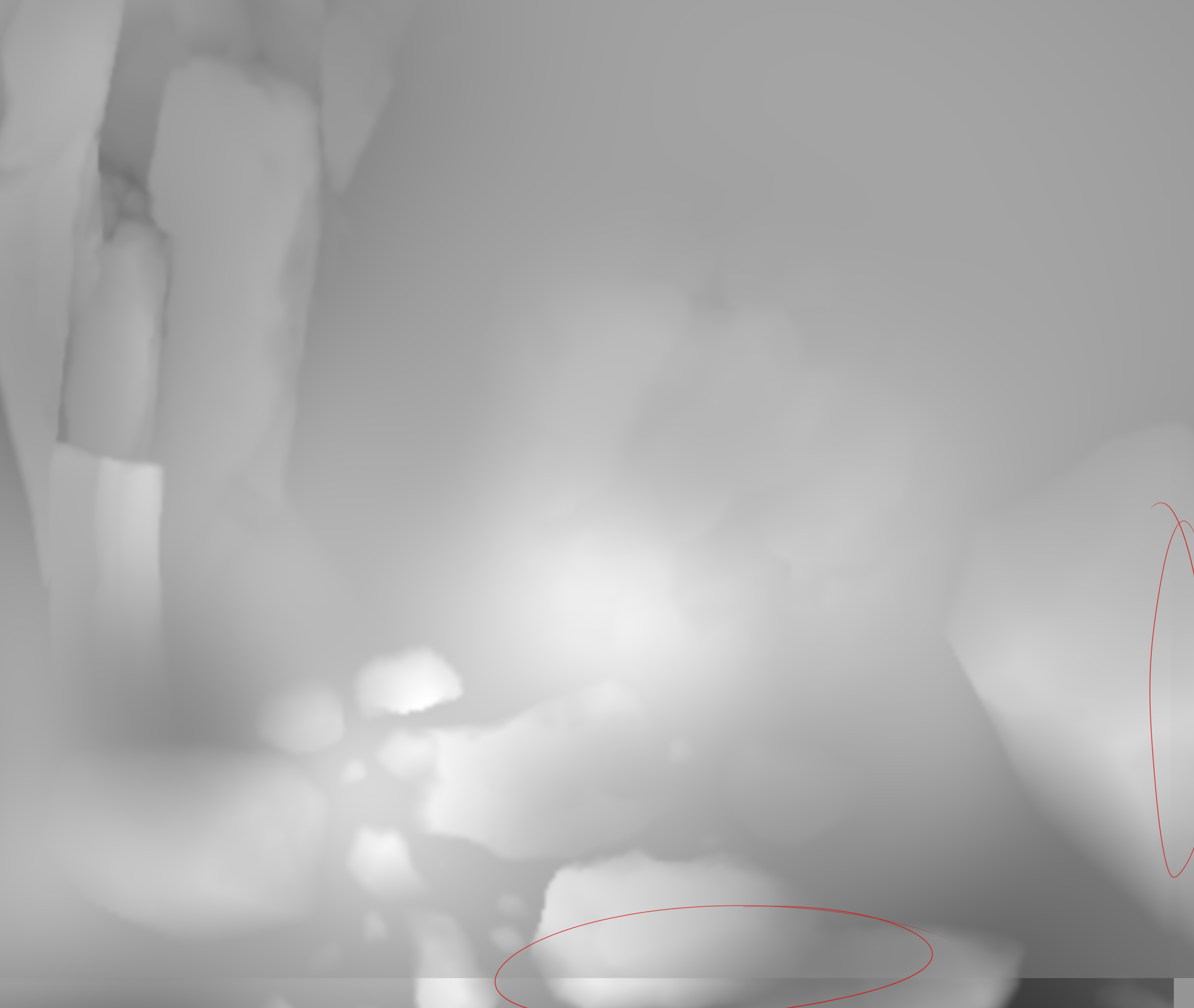 overlaps.jpg