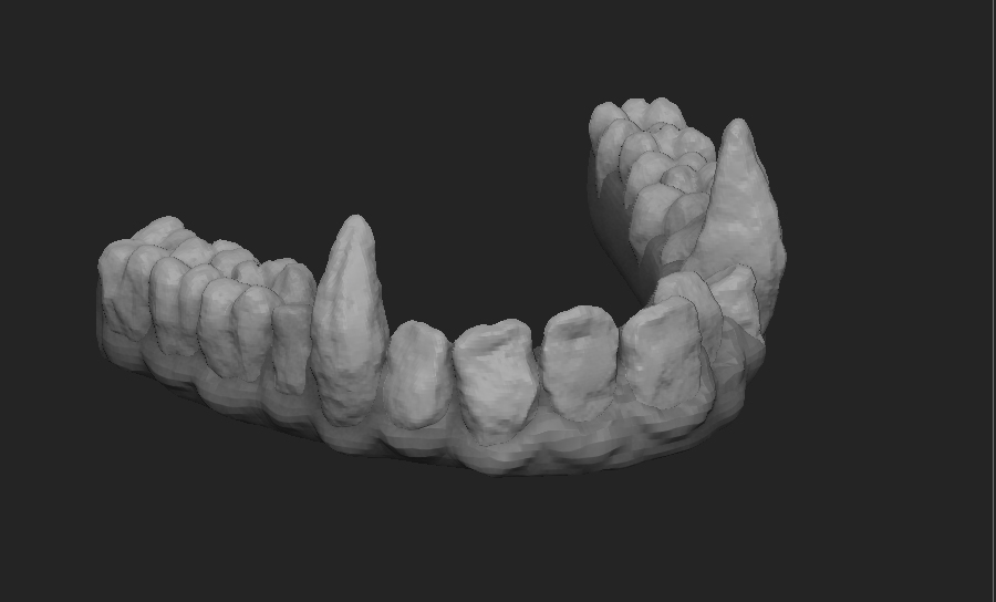 bottomTeeth.jpg