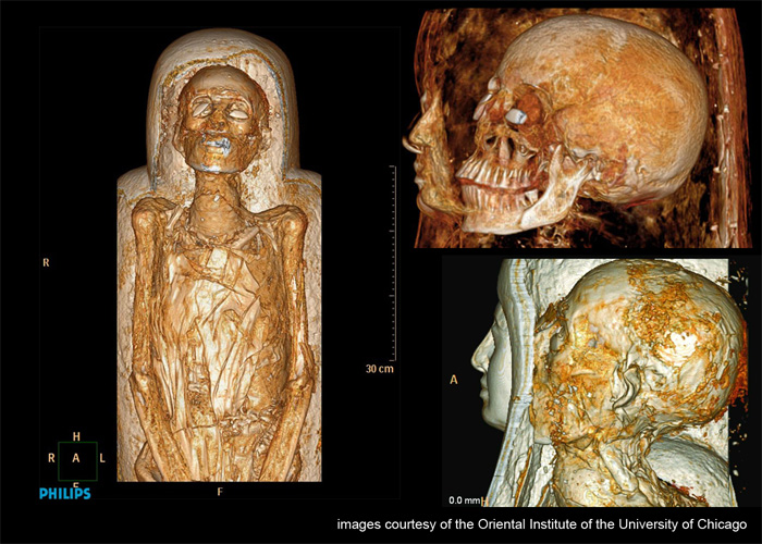 meresamun-CT-scans-2.jpg