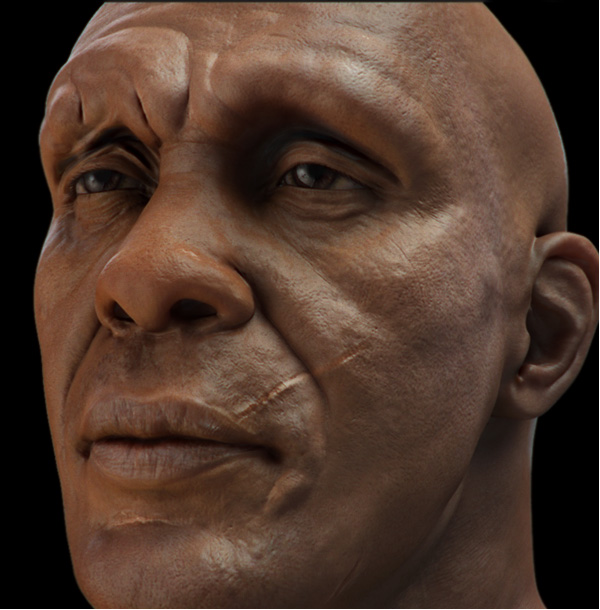 skin-test.jpg