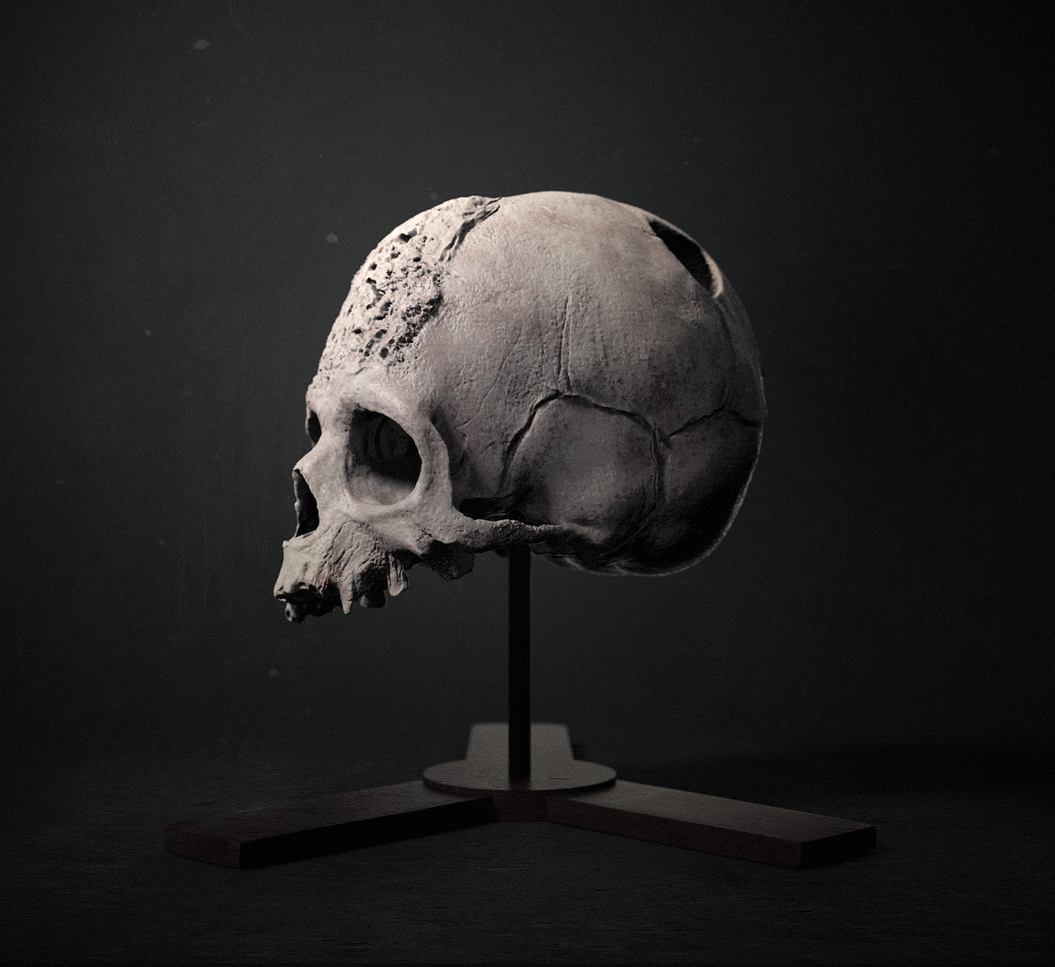 Syphilis Skull Render 04.jpg
