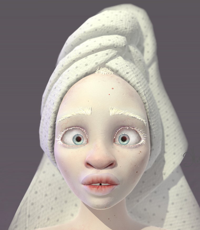Albino2