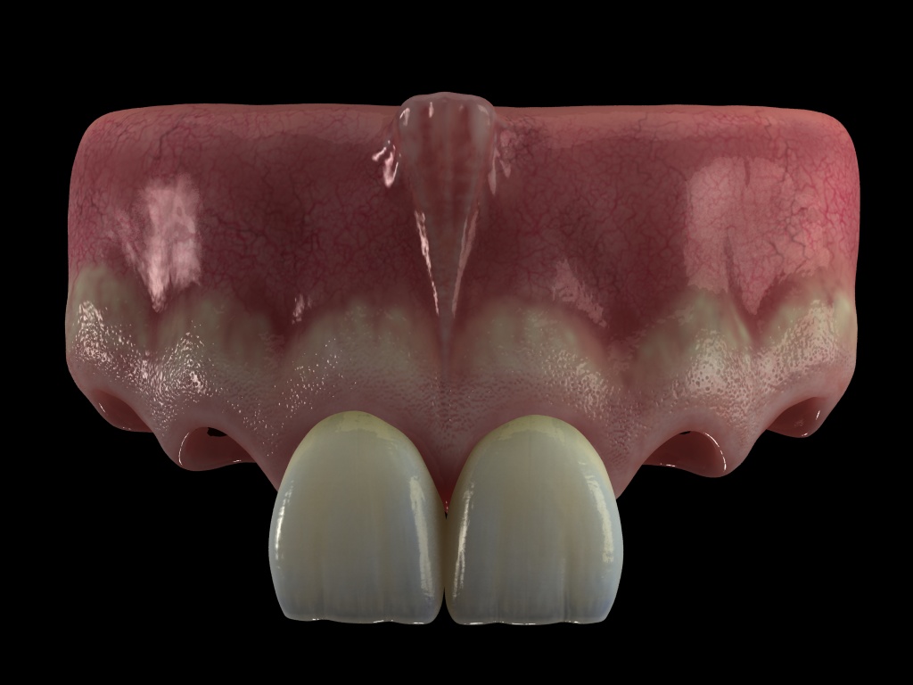 encia+dientes1.jpg