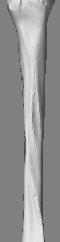 HumerusShaft_B_03.jpg