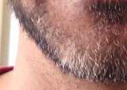 beard_example.jpg