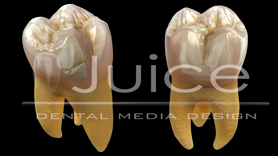 molar2b.jpg