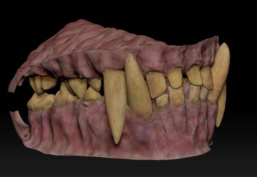 TeethProgress2.jpg