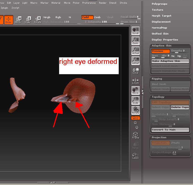 right eye deformed.jpg