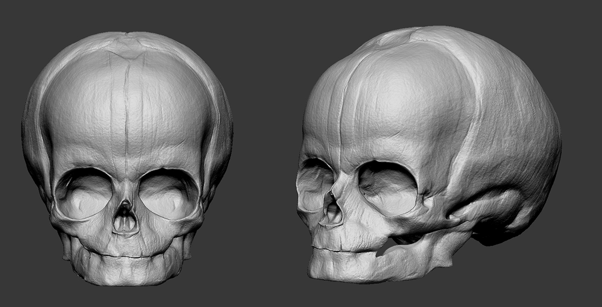 Fetal_Skull_Sculpt.jpg