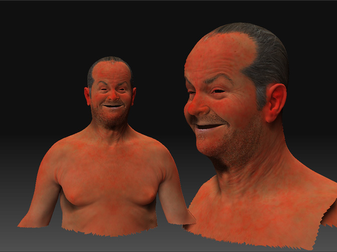 subdermal_zb.jpg