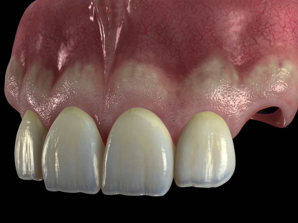 encia+dientes3.jpg