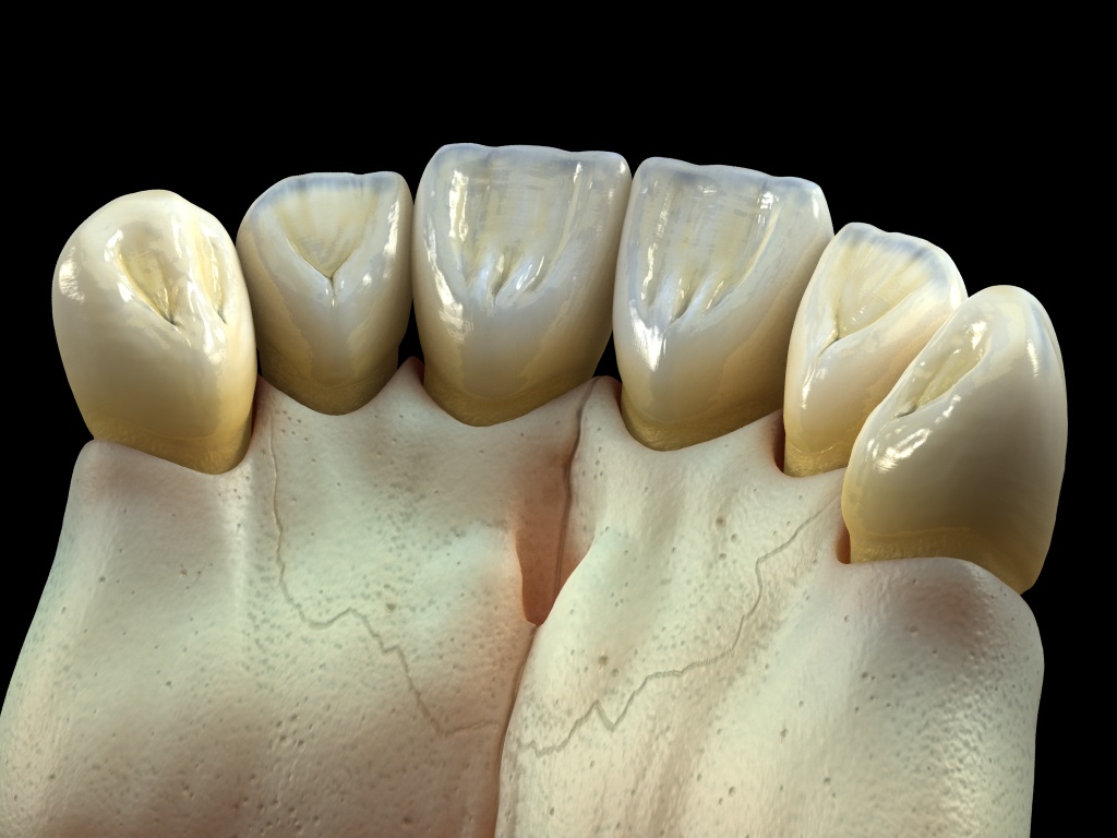 hueso+dientes5.jpg
