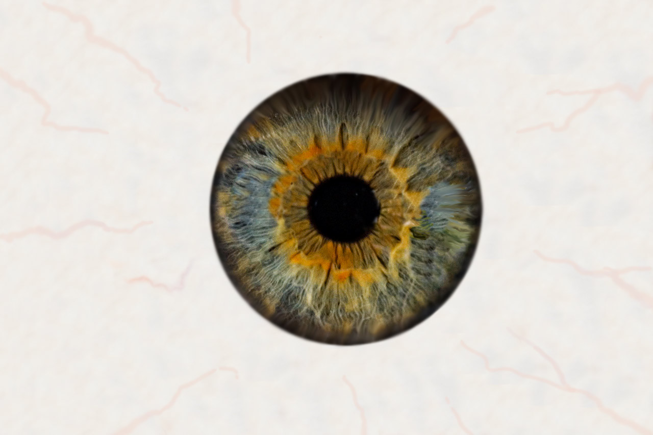 oog.jpg