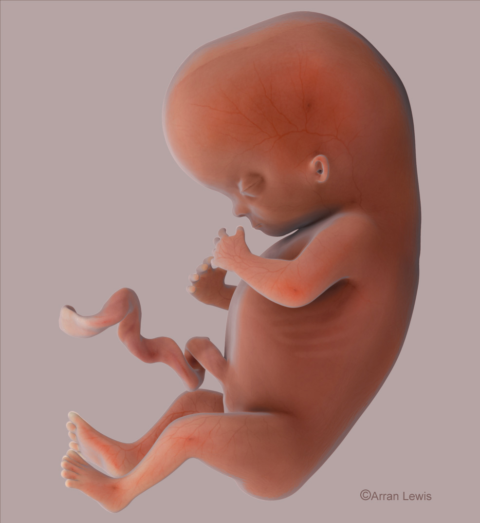 Transfetus.jpg