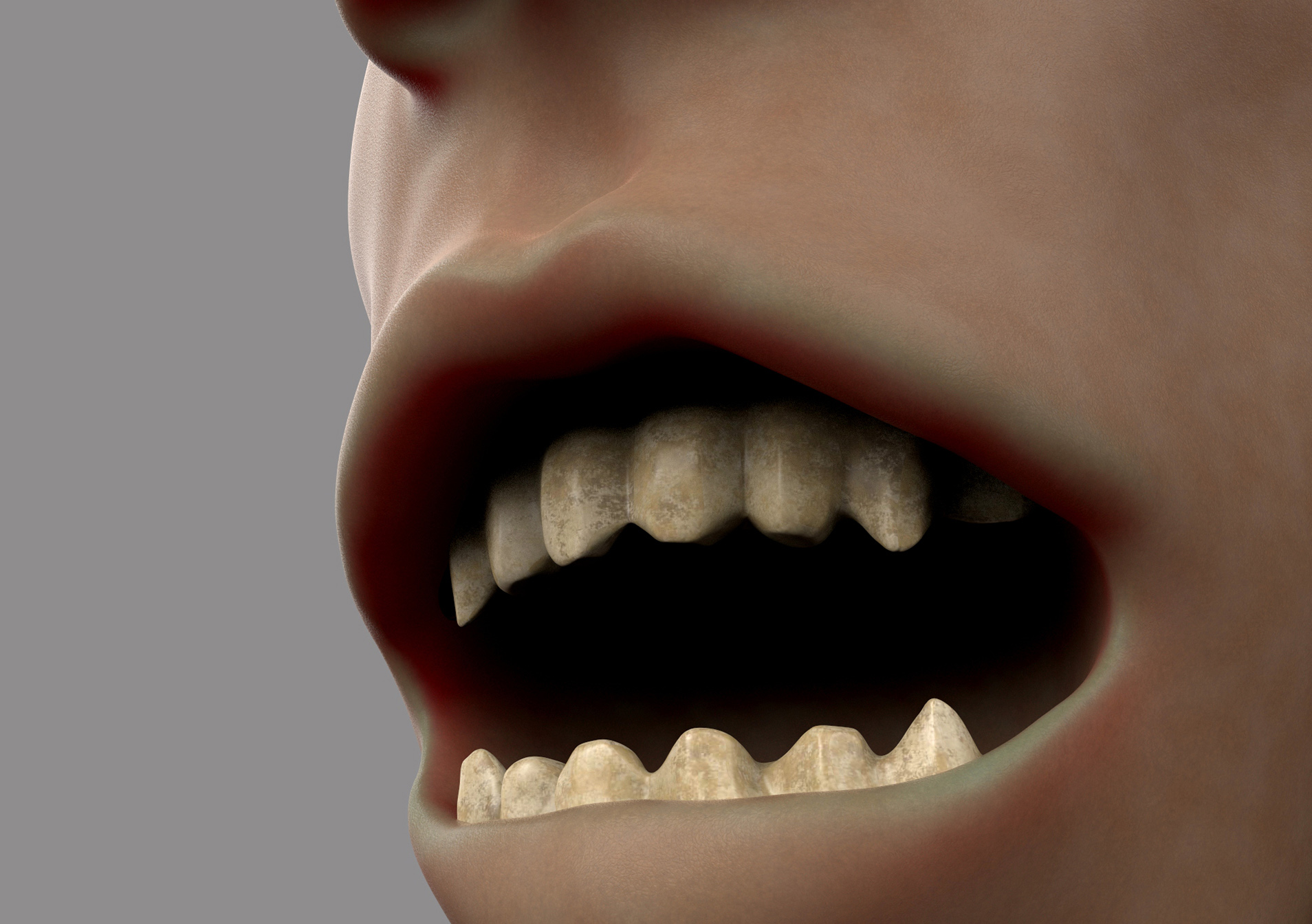 White Skin Teeth 2.jpg