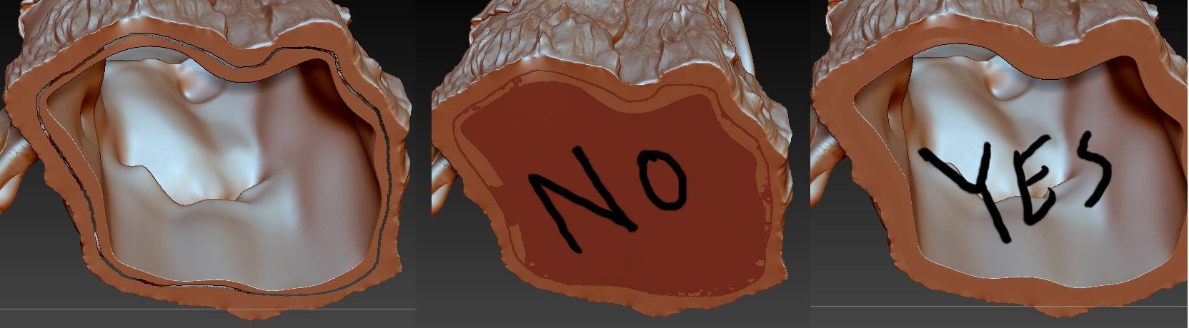 closeholeshelp.jpg