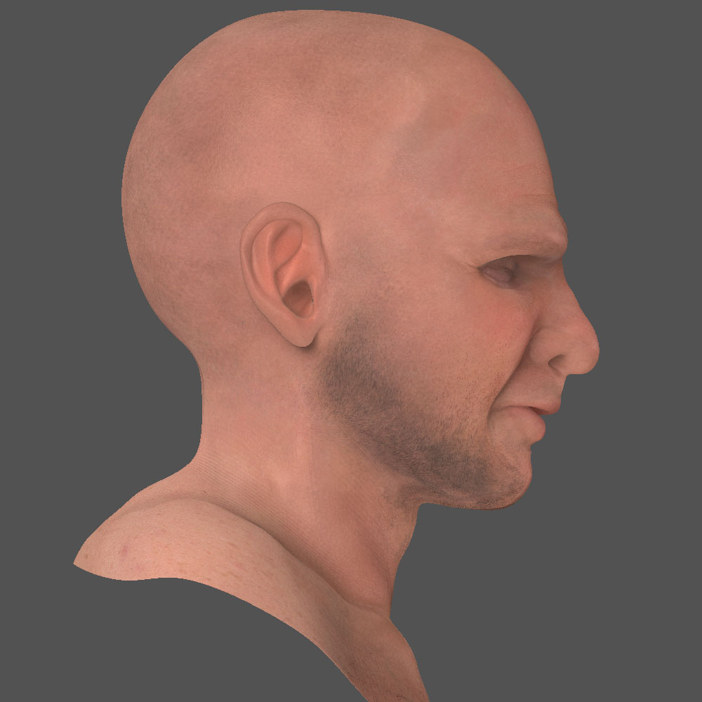 skin_side.jpg