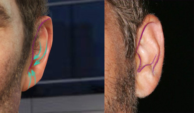 ears.jpg