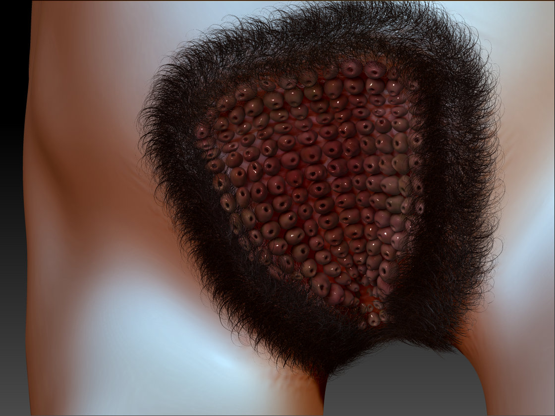 Pussypolyps.jpg