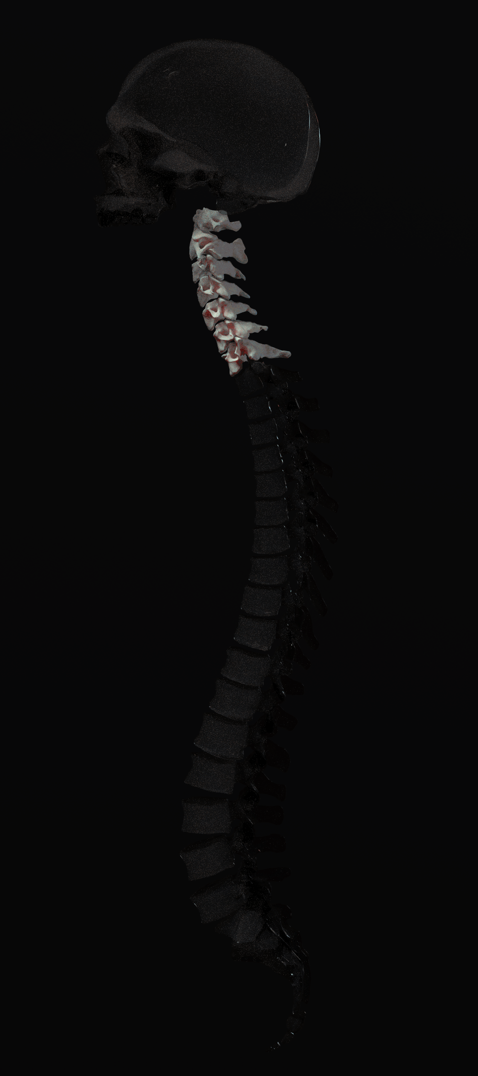 SpineLateral_seqence (1)