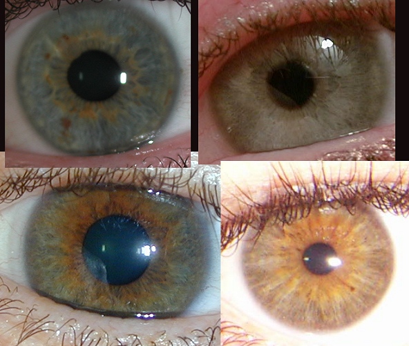 eye_examples.jpg