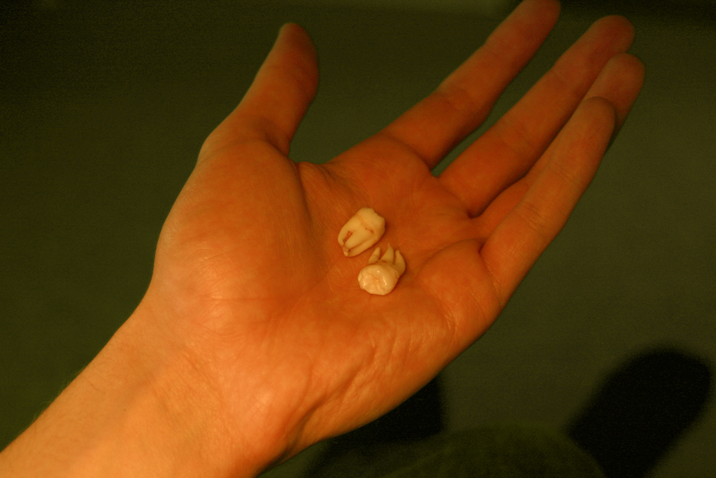 teeth.jpg
