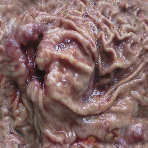 flesh011.jpg