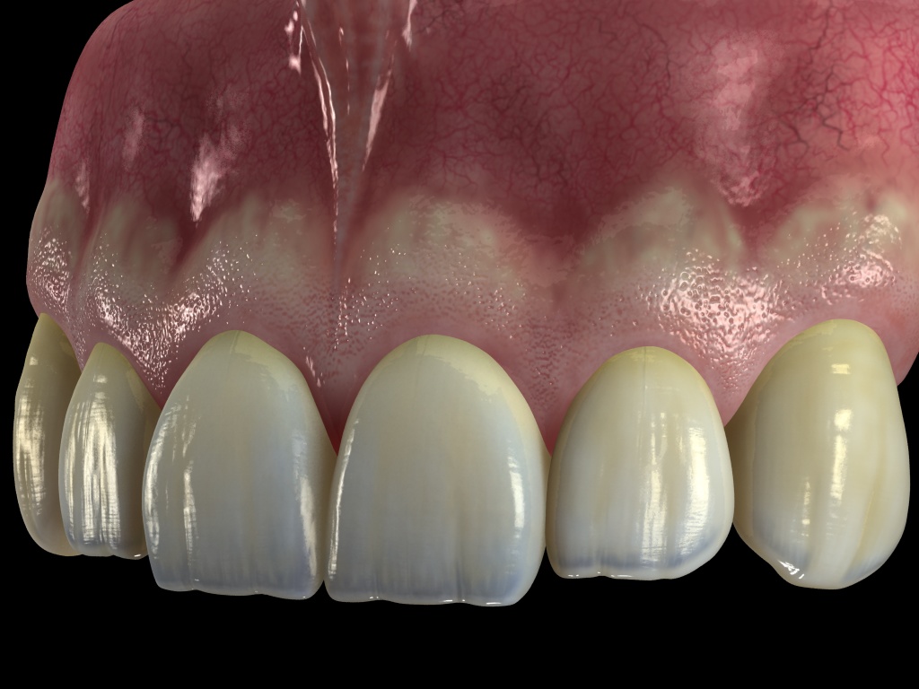 encia+dientes4.jpg